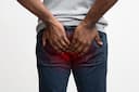 Laser Treatment for Piles: What You Need to Know Before Choosing It